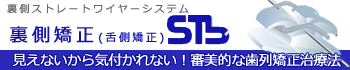 裏側矯正小型装置ネット-見えないから気付かれない！審美的な矯正歯科治療法